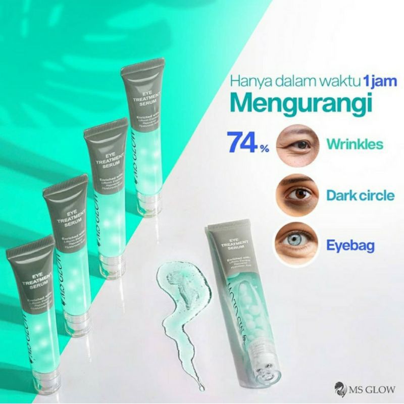 Serum Eye Treatment Ms Glow eye dark cyrcle msglow asli ori eye cream original Ms Glow